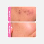 niacinamida-vitamina-b-clareador-fortalecedor-antioleosidade-creamy-5