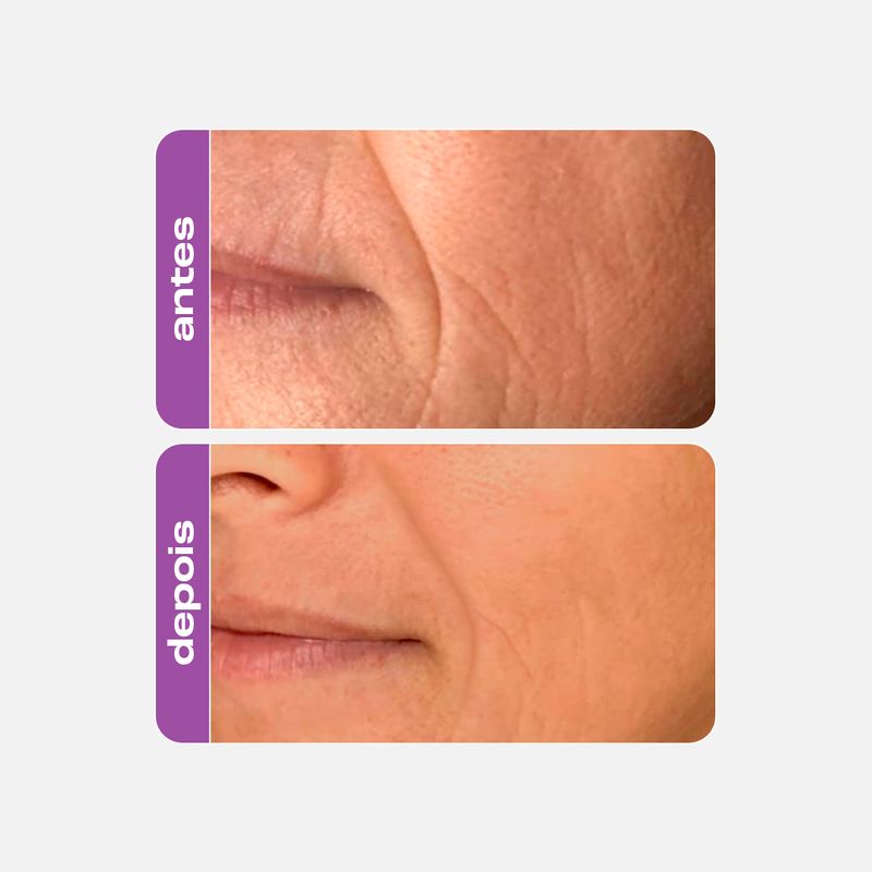 retinol-anti-aging-rugas-roxinho-creamy-5