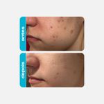 acido-glicolico-creamy-azulzinho-5